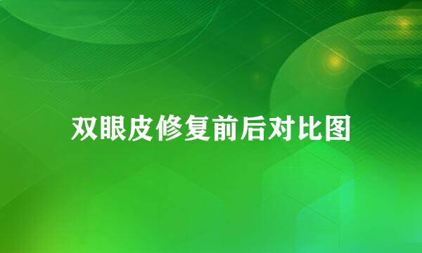 双眼皮修复前后对比图