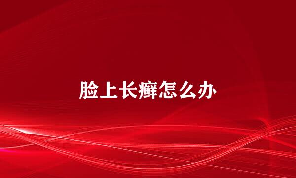 脸上长癣怎么办