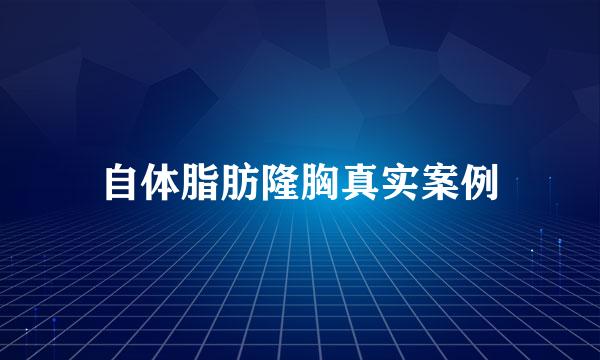 自体脂肪隆胸真实案例