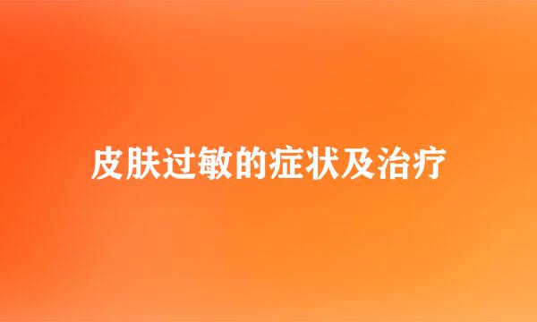 皮肤过敏的症状及治疗