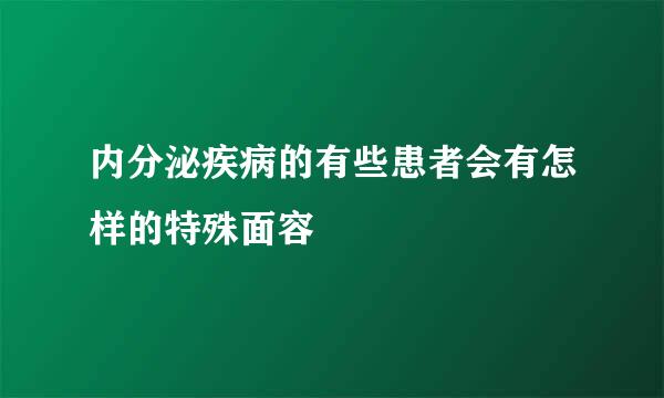 内分泌疾病的有些患者会有怎样的特殊面容