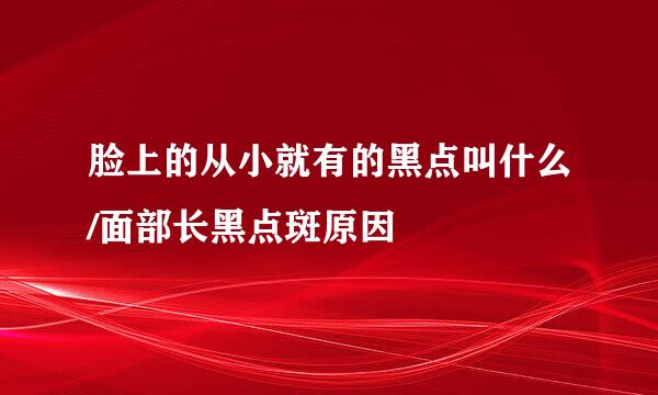 脸上的从小就有的黑点叫什么/面部长黑点斑原因