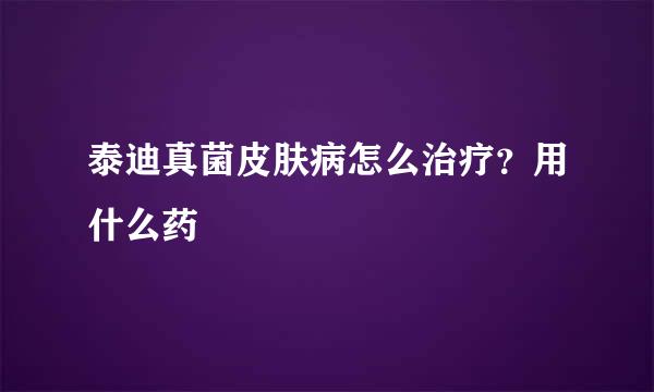 泰迪真菌皮肤病怎么治疗？用什么药