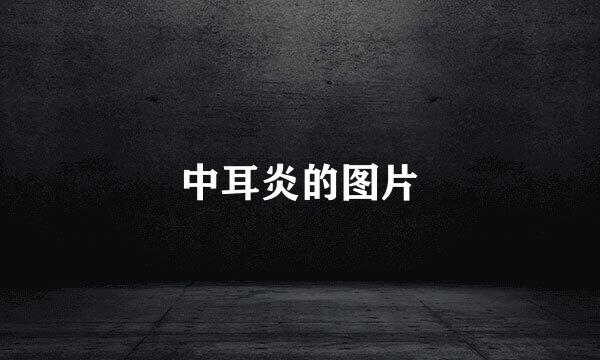 中耳炎的图片