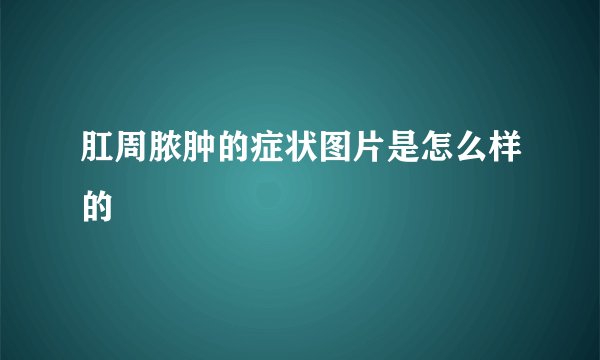 肛周脓肿的症状图片是怎么样的