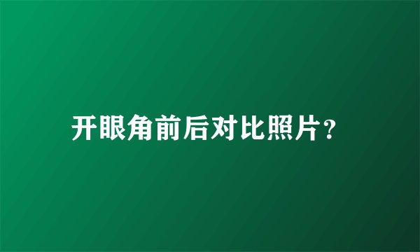 开眼角前后对比照片？