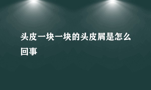 头皮一块一块的头皮屑是怎么回事