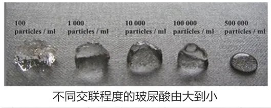 瑞蓝二号玻尿酸能维持多久 瑞蓝2号和3号的区别