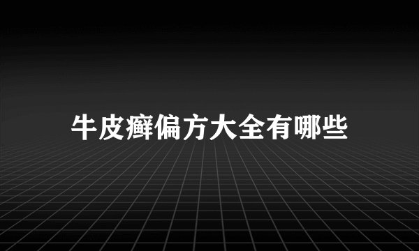 牛皮癣偏方大全有哪些