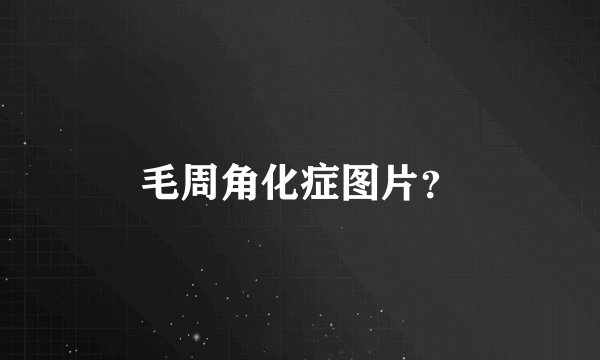 毛周角化症图片？