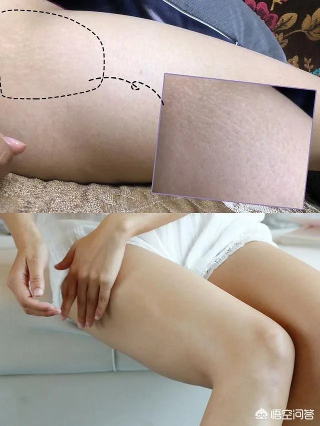 瘦身塑形的方法有哪些?