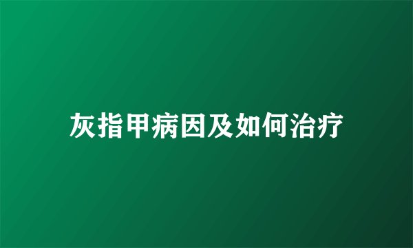 灰指甲病因及如何治疗