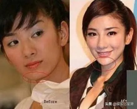 哪些女星本是天生丽质,却因整容整残了?
