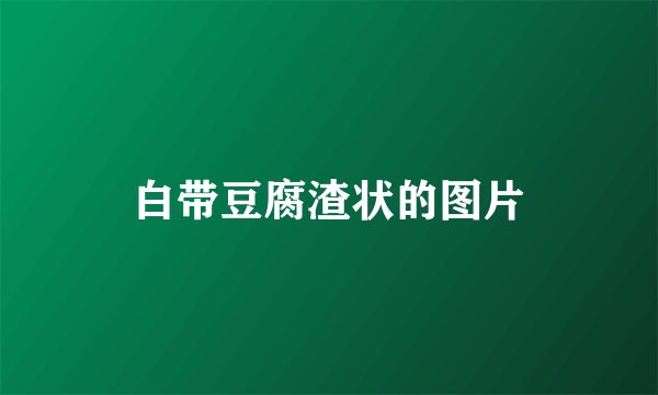 白带豆腐渣状的图片