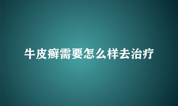 牛皮癣需要怎么样去治疗
