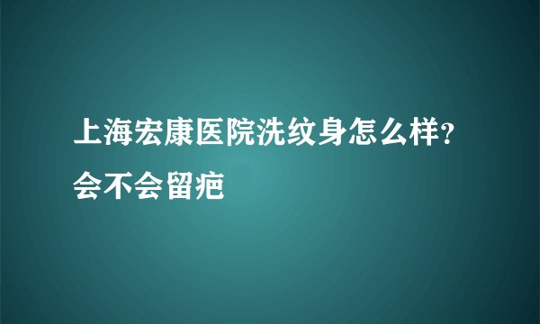 上海宏康医院洗纹身怎么样?会不会留疤