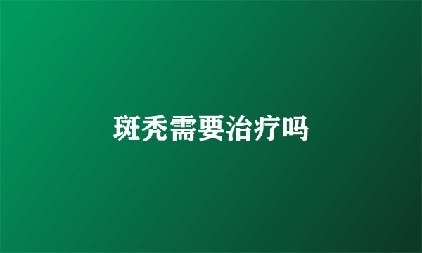 斑秃需要治疗吗