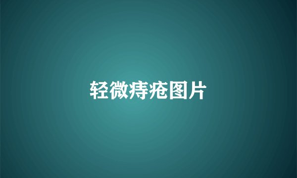 轻微痔疮图片