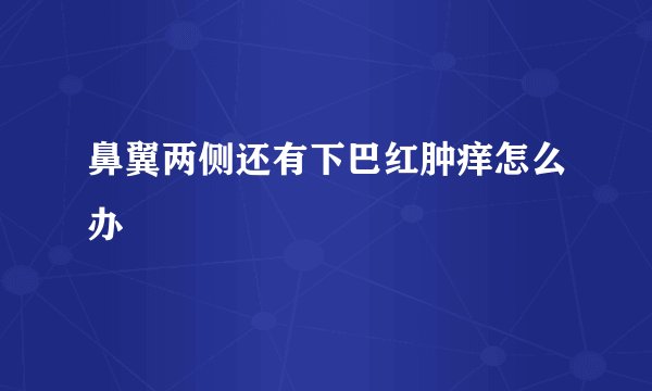 鼻翼两侧还有下巴红肿痒怎么办
