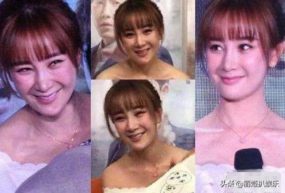 哪些女星本是天生丽质,却因整容整残了?