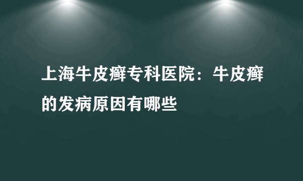 上海牛皮癣专科医院:牛皮癣的发病原因有哪些