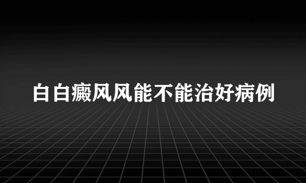 白白癜风风能不能治好病例