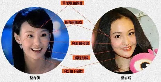 哪些女星本是天生丽质,却因整容整残了?