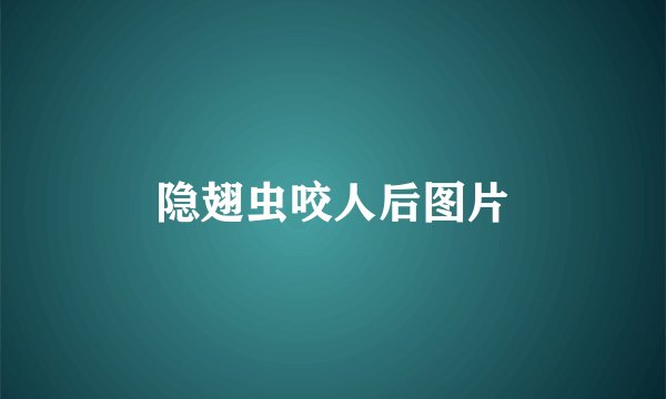 隐翅虫咬人后图片
