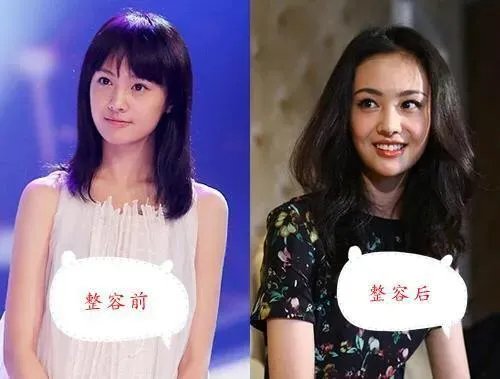 哪些女星本是天生丽质,却因整容整残了?