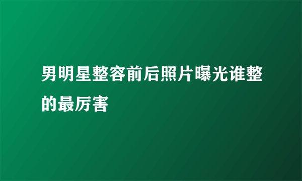 男明星整容前后照片曝光谁整的最厉害