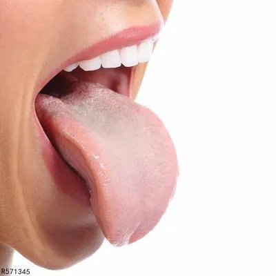 舌头上好多白色的绒毛是怎么回事