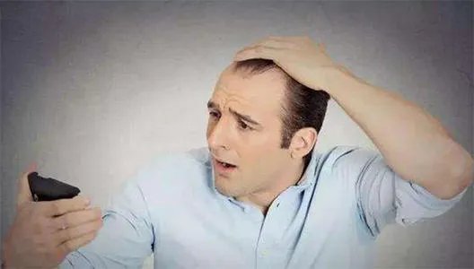 艾福杰尼谢广坤同款秃头笑翻全场,你如何看待年轻人秃头问题?
