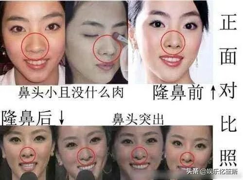 哪些女星本是天生丽质,却因整容整残了?