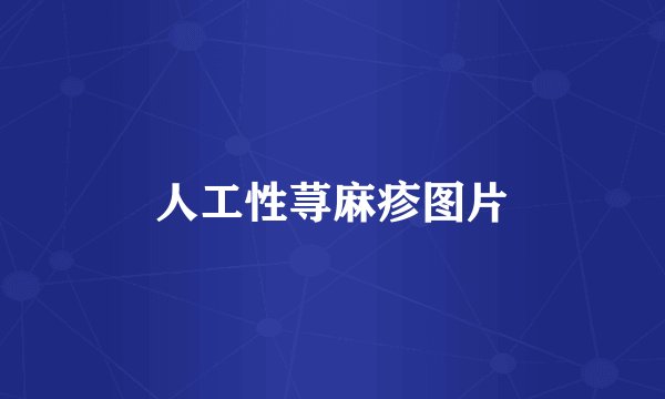 人工性荨麻疹图片