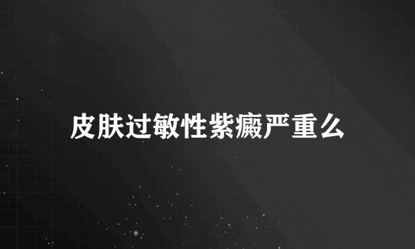 皮肤过敏性紫癜严重么