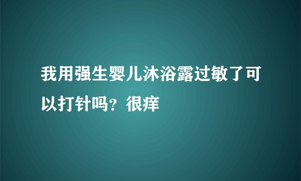 我用强生婴儿沐浴露过敏了可以打针吗？很痒