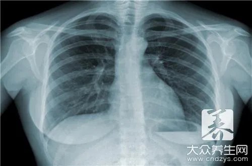 结核病防治知识内容是什么?
