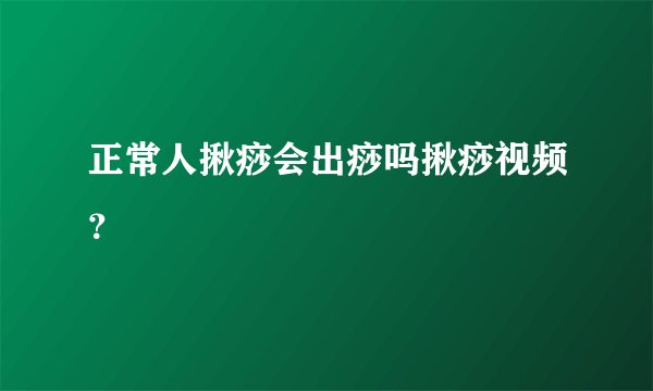 正常人揪痧会出痧吗揪痧视频？