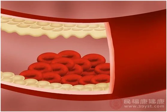 A型血的人容易得什么病