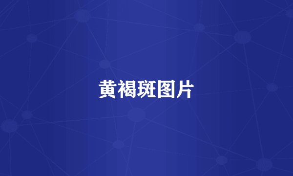 黄褐斑图片