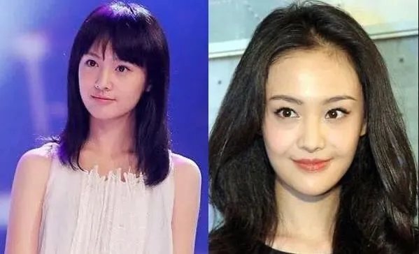 哪些女星本是天生丽质,却因整容整残了?