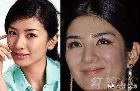 哪些女星本是天生丽质,却因整容整残了?
