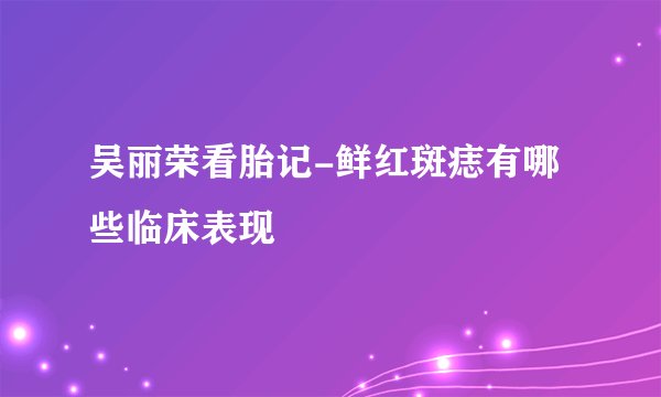 吴丽荣看胎记-鲜红斑痣有哪些临床表现