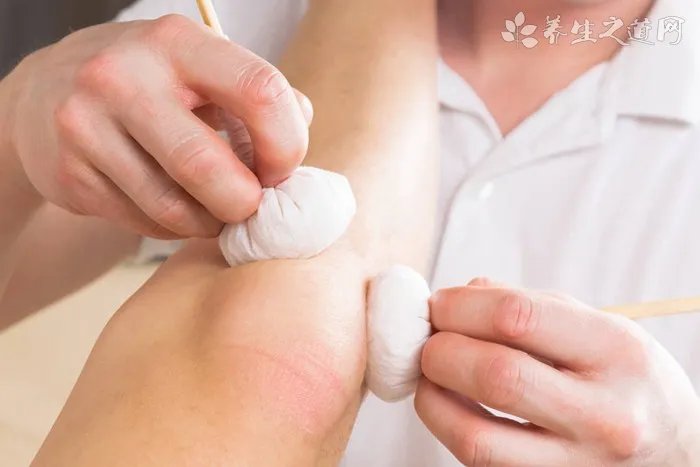 畸胎瘤是怎么形成的