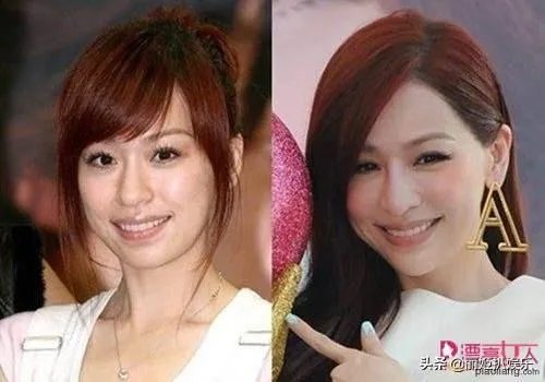 哪些女星本是天生丽质,却因整容整残了?
