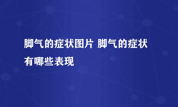 脚气的症状图片 脚气的症状有哪些表现
