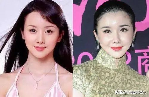 哪些女星本是天生丽质,却因整容整残了?
