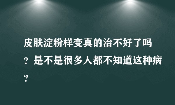皮肤淀粉样变真的治不好了吗？是不是很多人都不知道这种病？