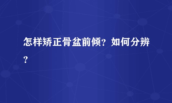 怎样矫正骨盆前倾？如何分辨？